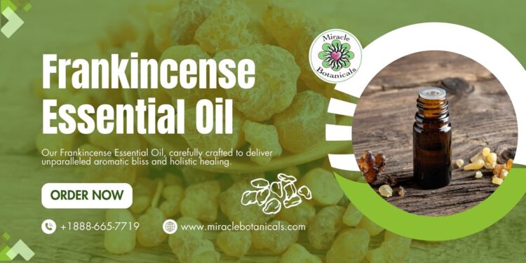 Frankincense Essential Oil