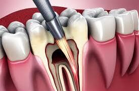 The Convenience and Benefits of a House Call Dentist: Exploring Mobile Dentistry Solutions