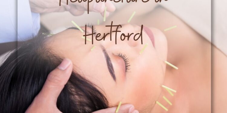 The Benefits of Pairing Acupuncture with Fertility Treatment