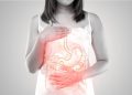 Cure for Gastrointestinal Disease: Modern Approaches to Digestive Health