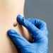 Why Regular Skin And Mole Checks Are Essential For Early Detection